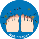 Nail-Infectionwould-infection-Test.png