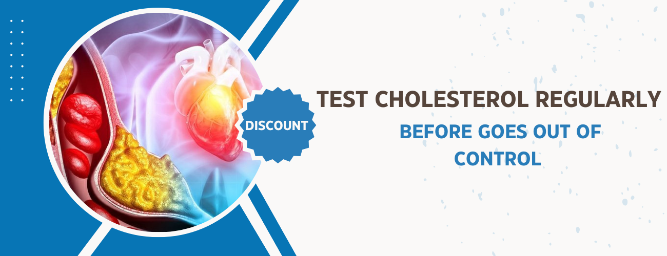 test cholesterol